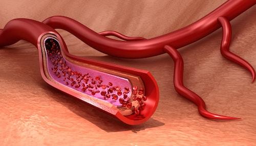 血管とその中を流れる血色素